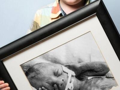 Παιδιά που γεννήθηκαν πρόωρα, μεγάλωσαν ...