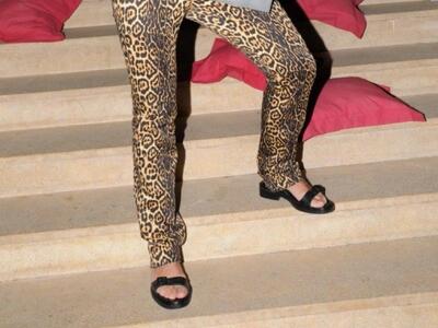 Σε ποιον Έλληνα τραγουδιστή ανήκουν αυτά τα πόδια;