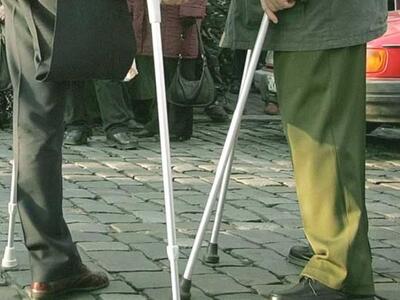 Νευροπροσθετικό εμφύτευμα δίνει ελπίδες ...