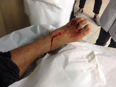 ΑΝΤΑΡΣΥΑ Πάτρας: Βάρβαρη επίθεση λιμενικ...