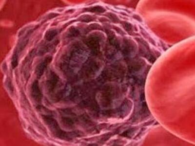 Ποιες νέες πρωτεΐνες συνδέονται με τον καρκίνο; 