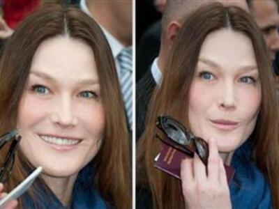 Σα να το παράκανε με τα μπότοξ η κυρία Bruni!