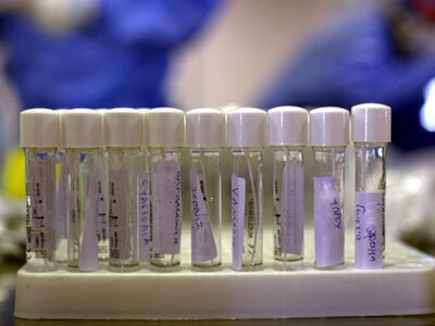 Πάτρα: Πού θα γίνουν αύριο δωρεάν rapid tests