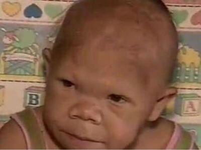 Σοκαριστικό: H γυναίκα που έμεινε για πάντα μωρό