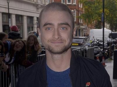 Daniel Radcliffe: Ξύρισε τα μαλλιά του -...