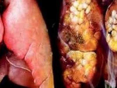 Τι συμβαίνει στο σώμα μας όταν κόψουμε τ...