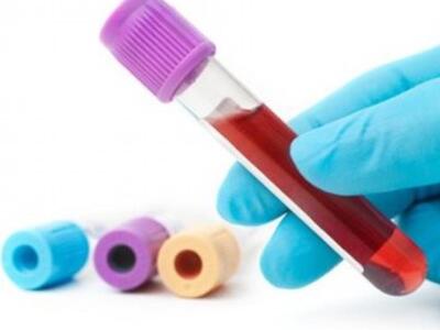 Πειραματική εξέταση αίματος υπόσχεται πρ...