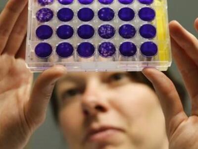 Μόλις το 8,2% του ανθρώπινου DNA είναι λειτουργικό