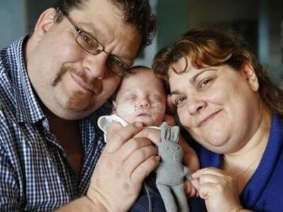 Ελληνόπουλο το μικρότερο μωρό που γεννήθ...