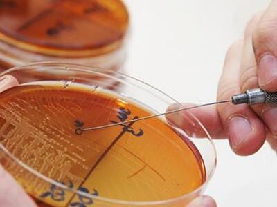 Ποιοι τύποι καρκίνου «θερίζουν» στην Ελλ...