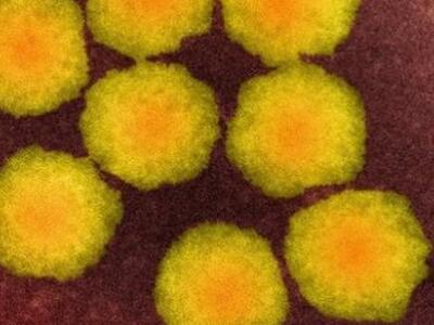 Σπάνια μη θεραπεύσιμη μολυσματική νόσος ...