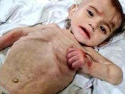 Διεθνής Αμνηστία: Η πείνα όπλο Άσαντ κατ...