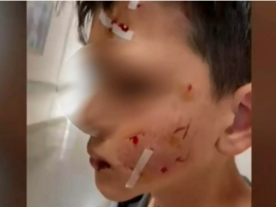 «Θα το σκότωνε» – Ξεσπά ο παππούς του αγ...