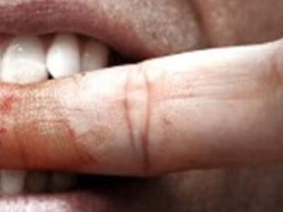 Ηλεία: Υποψήφιος τοπικός σύμβουλος δάγκω...