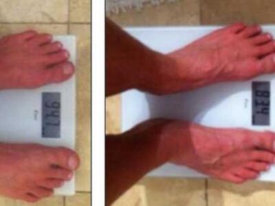 Τρελό πείραμα! – Έχασε 11 κιλά σε 24 ώρες!