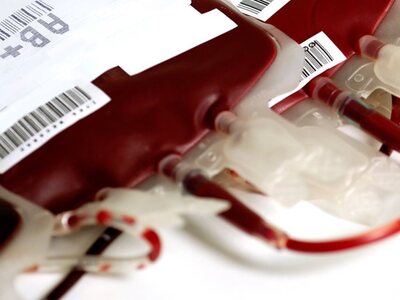 Εθελοντική αιμοδοσία την Πέμπτη στην Οβρυά Πατρών