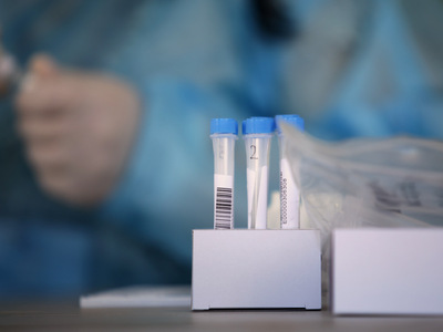 Κορωνοϊός: ΔΕΙΤΕ που εντοπίστηκαν τα 3.0...