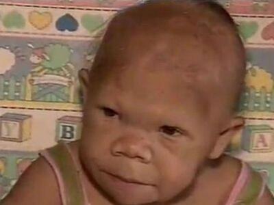 Σοκαριστικό: H γυναίκα που έμεινε για πάντα μωρό