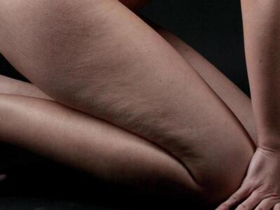 Τι πρέπει να τρώτε για να νικήσετε την κ...