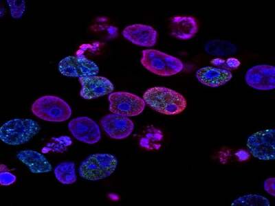 Καρκίνος: Νέα τεχνολογία για τη διάγνωση...