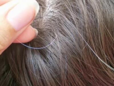 Βγάλε μία άσπρη τρίχα και θα εμφανιστούν...