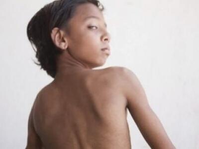 Τον λατρεύουν σαν θεό επειδή έχει ουρά 1...