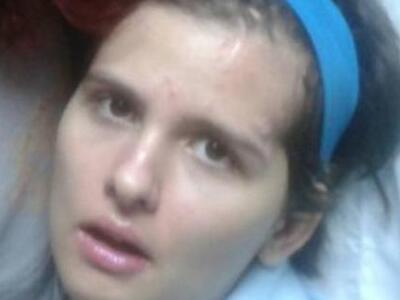 Συγκλονίζουν οι φωτογραφίες της 16χρονης...