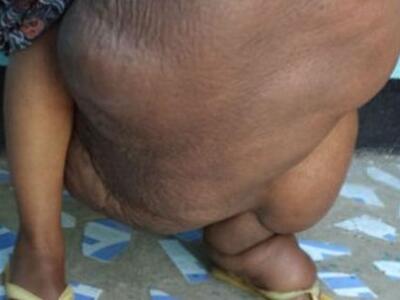 Το πόδι της ζυγίζει πάνω από 31 κιλά...