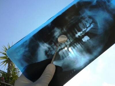 Δείτε πώς Πατρινός οδοντίατρος παρακολού...