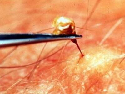 Δείτε που πονάει περισσότερο το τσίμπημα...