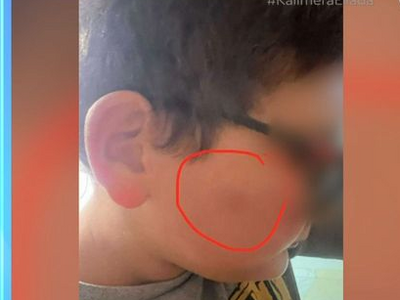 Θεσσαλονίκη: Xτύπησαν 11χρονο στο διάλει...