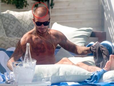 Ο David Beckham χάνει τα μαλλιά του! ΦΩΤΟ 
