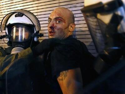 AYTH η φωτογραφία με τον ματωμένο διαδηλ...