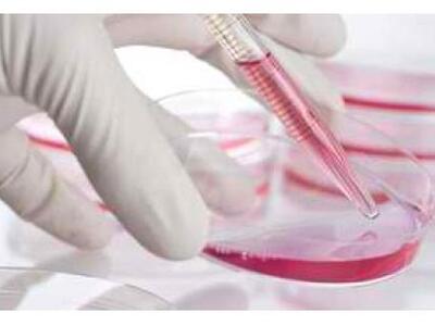 Φόβοι για εξάπλωση του Έμπολα στη Νιγηρί...