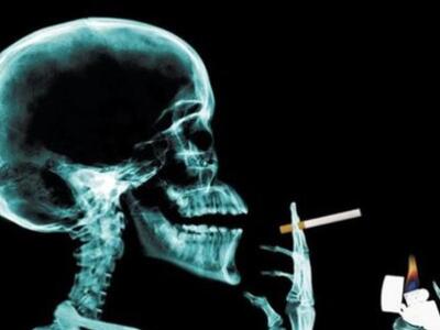 Οι άνδρες καπνιστές χάνουν το χρωμόσωμα ...