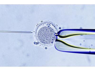 Έμβρυα «τριών-γονέων» με την έγκριση της...