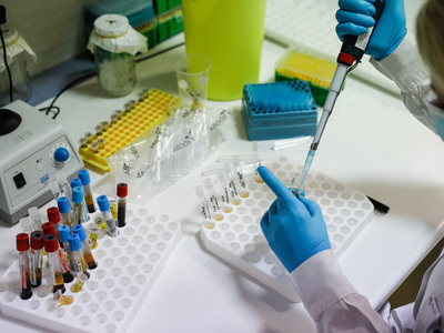 Αγρίνιο: Δύο αδέρφια με θετικά rapid tes...