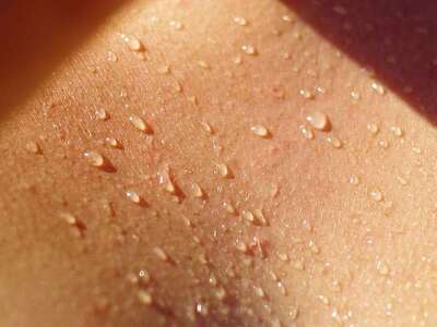 Ανιδρωσία- 15χρονος: Πώς μπορεί να προκα...