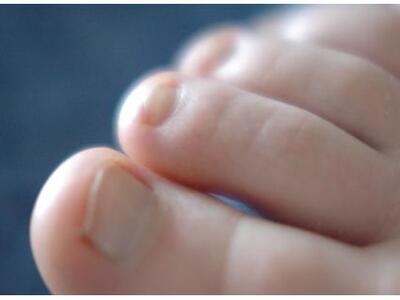 Χειρουργική λύση στα προβλήματα των δακτ...