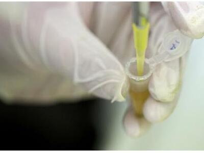 Σε καραντίνα ασθενής στην Ισπανία λόγω υ...