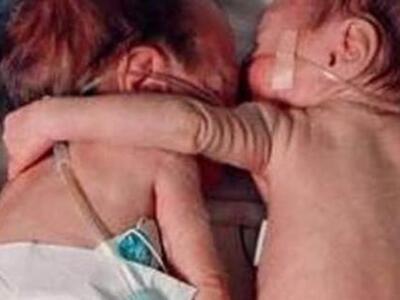 Μία αγκαλιά αγάπης και επιβίωσης «ζει» κ...