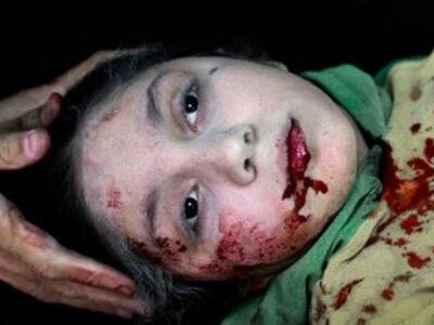 Με το βλέμμα στο κενό -Η σπαρακτική φωτο...