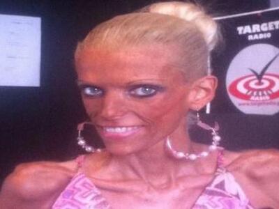 Nανά Καραγιάννη: Οι φωτογραφίες που σοκά...