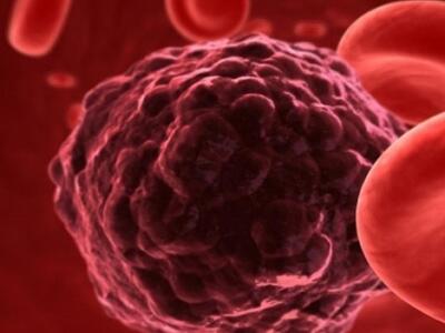 Ο καρκίνος ξεπέρασε την καρδιά ως κύρια ...