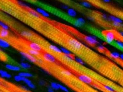 Κατασκευάστηκε σκελετικός μυς που έχει τ...