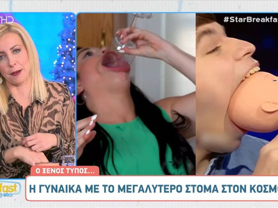 Η γυναίκα με το μεγαλύτερο στόμα στον κόσμο