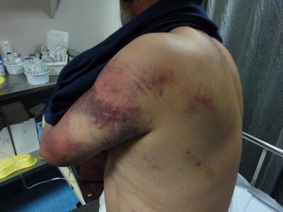 Άγριος ξυλοδαρμός άνδρα από άγνωστο, στο...