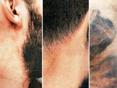 Πατρινός καταγγέλλει τον βάναυσο ξυλοδαρ...