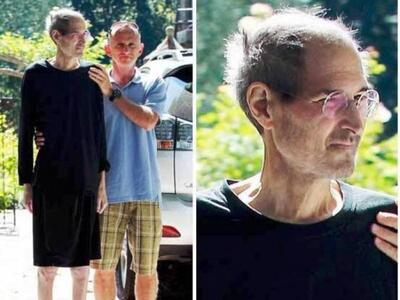 Σοκαριστική φωτογραφία του καρκινοπαθούς Mr Apple 