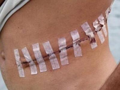 Κατεχόμενα: Εμπόριο οργάνων με δότες Ουκ...